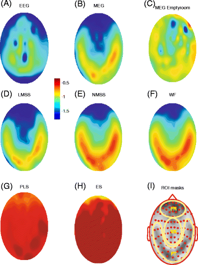 Comparative power spectral analysis of simultaneous electroencephalographic and magnetoencephalographic recordings in humans suggests non-resistive extracellular media