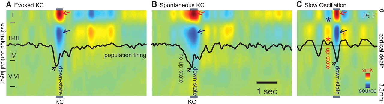The Human K-Complex as an Isolated Cortical "Down-State"