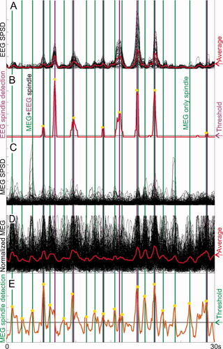 Emergence of synchronous EEG spindles from asynchronous MEG spindles