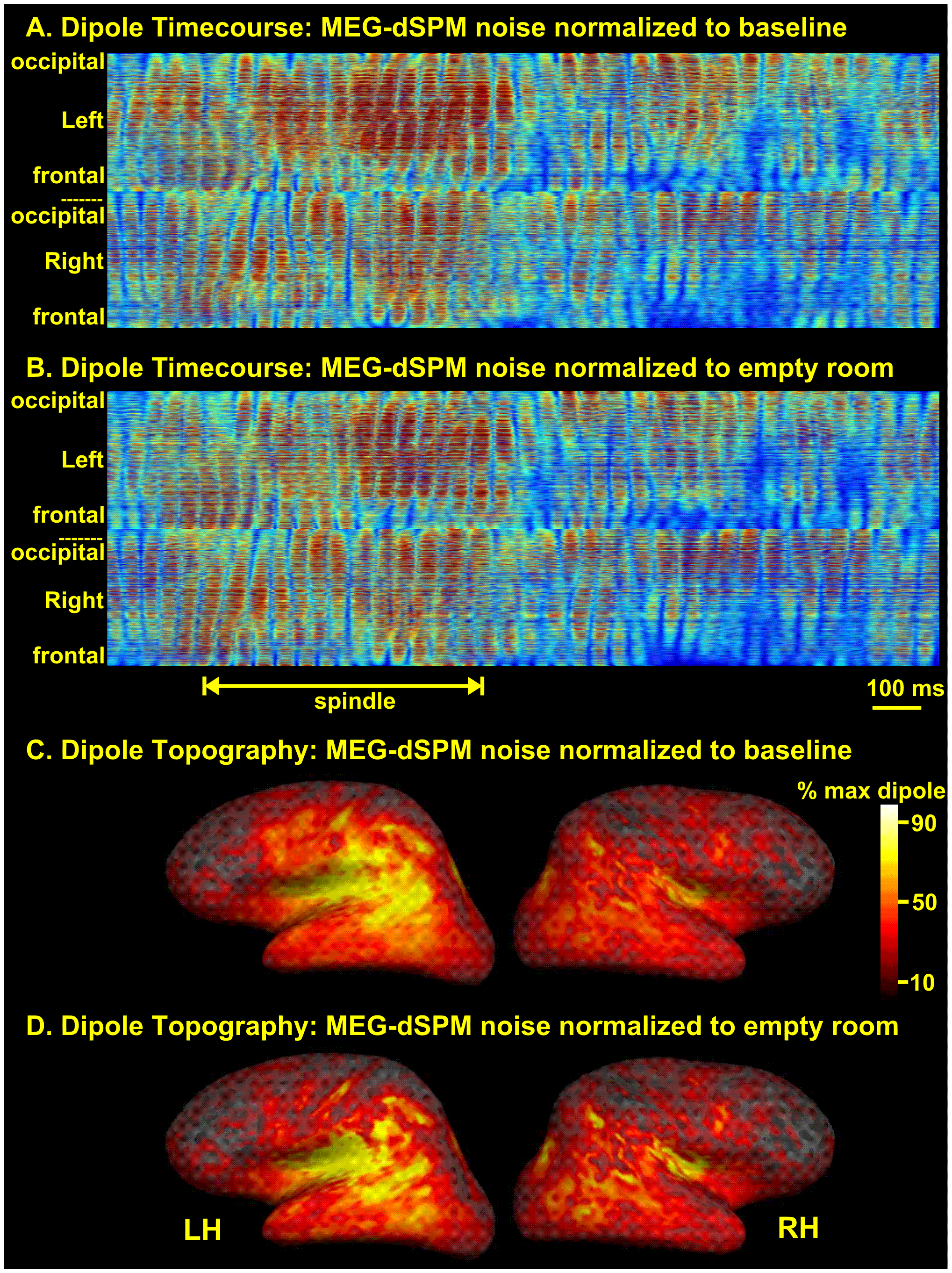 Divergent Cortical Generators of Sleep Spindles
